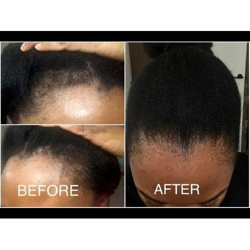 Reebonn 3 In1 Combo Super Hair Booster, Hair Growth Oil & Cream