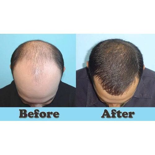 Reebonn 3 In1 Combo Super Hair Booster, Hair Growth Oil & Cream